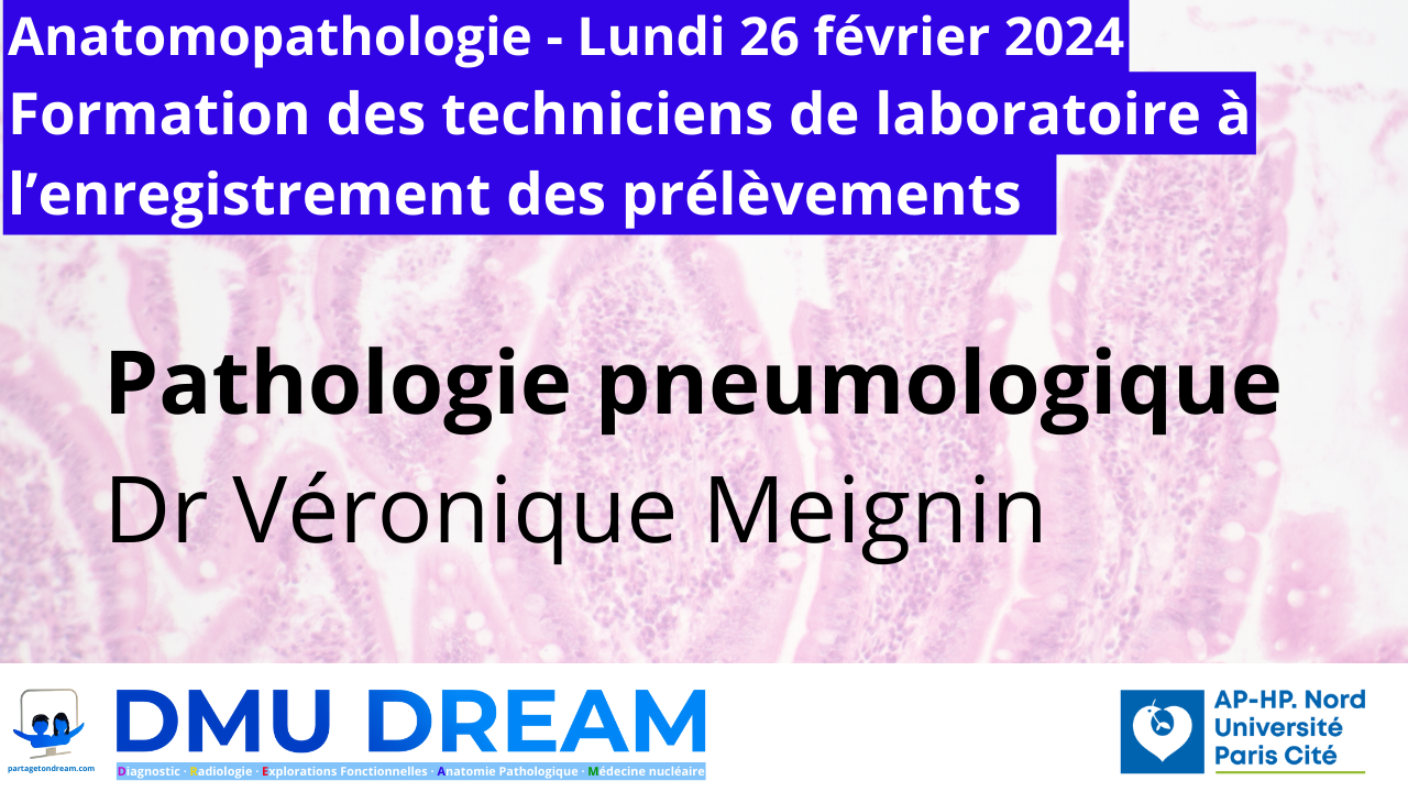Lien connexion Teams – Formation enregistrement – Pathologie pneumologique ACP 26/02/2024